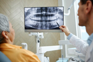 レントゲン写真を見せながら説明する歯科医師と患者
